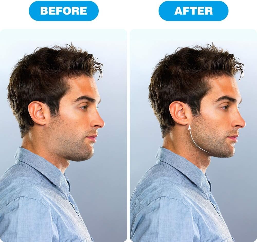 Jawline Exerciser Tool Pack Of 2